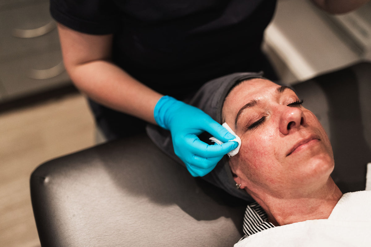Gloved clinician applying a chemical peel to a patient's cheek at Element Dermatology