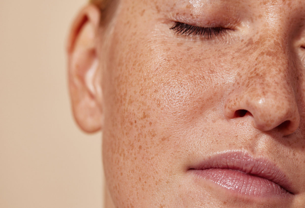 Close-up of a woman's cheek with natural freckles and an even complexion