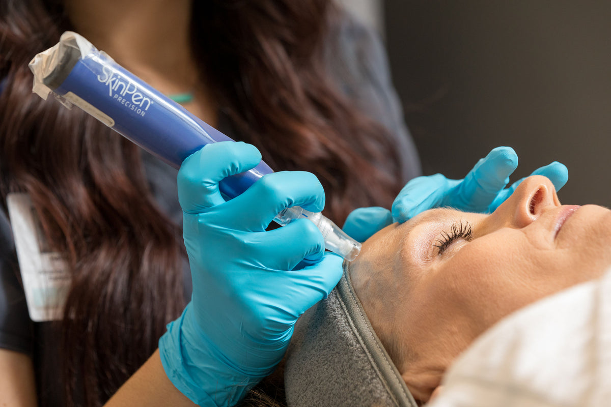 Gloved clinician applying a SkinPen microneedling device to a patient's face at Element Dermatology