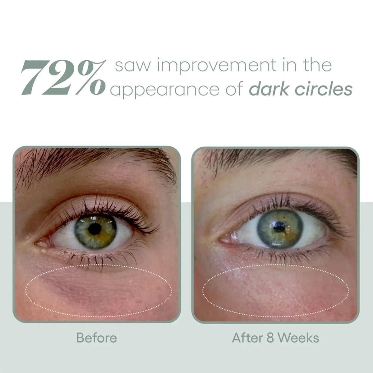 Plated Eye Serum before and after results