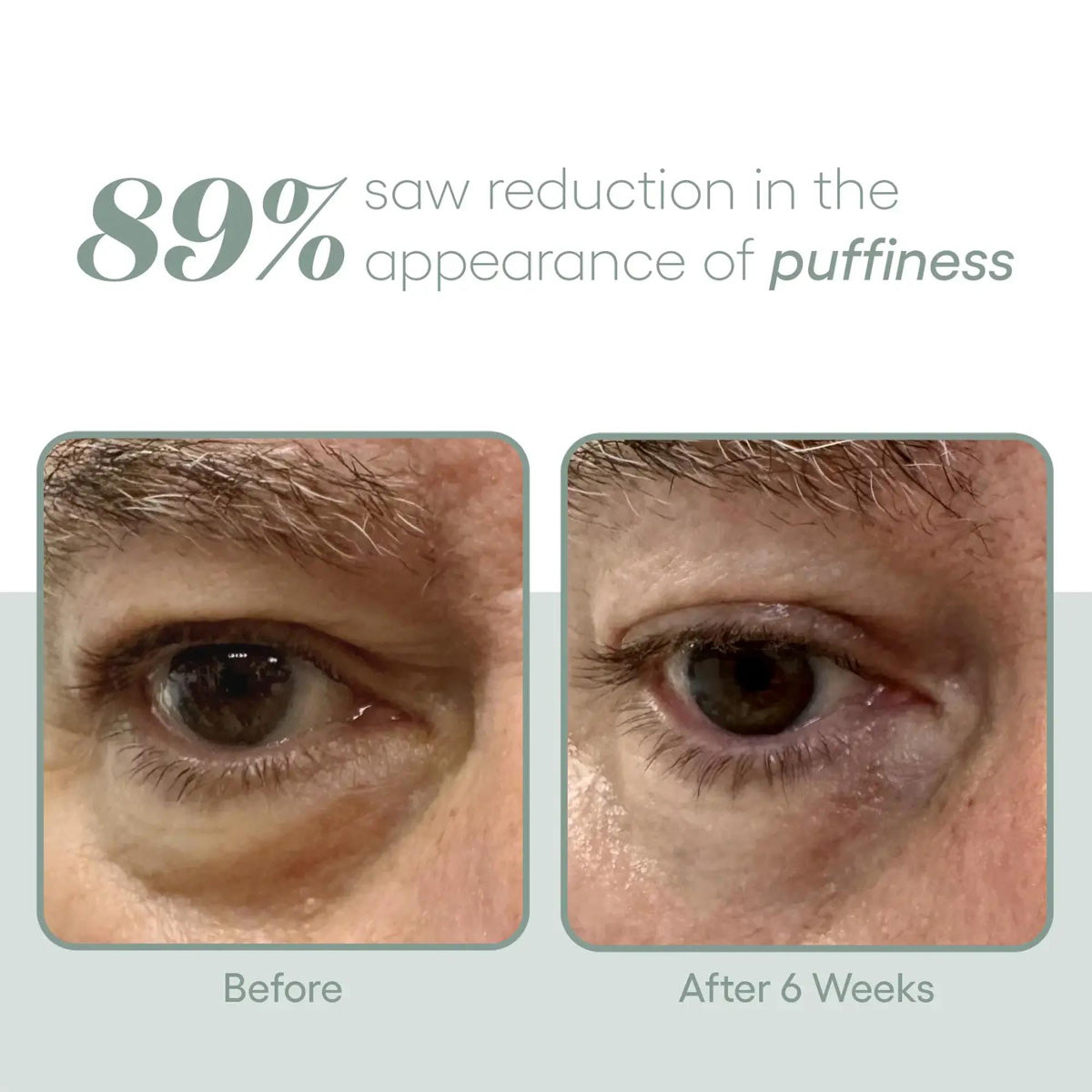 Plated Eye Serum before and after results