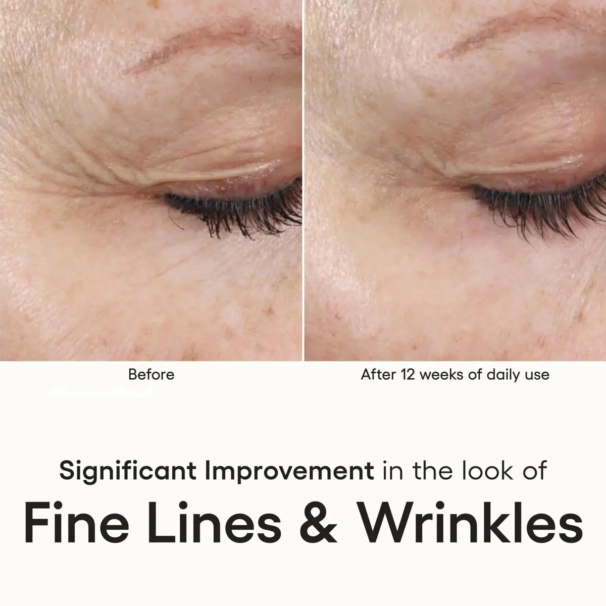 Plated Intense Serum before and after results