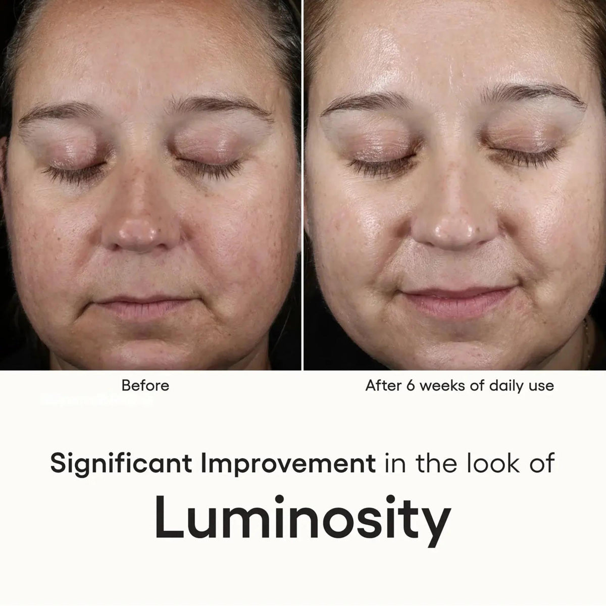 Plated Intense Serum results timeline