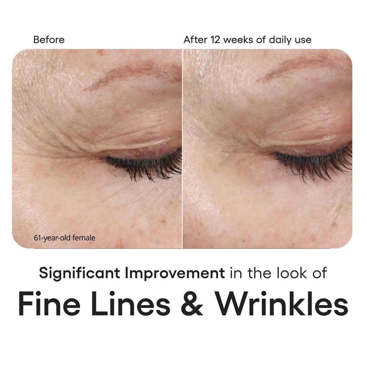 Plated INTENSE Serum Refill before and after results
