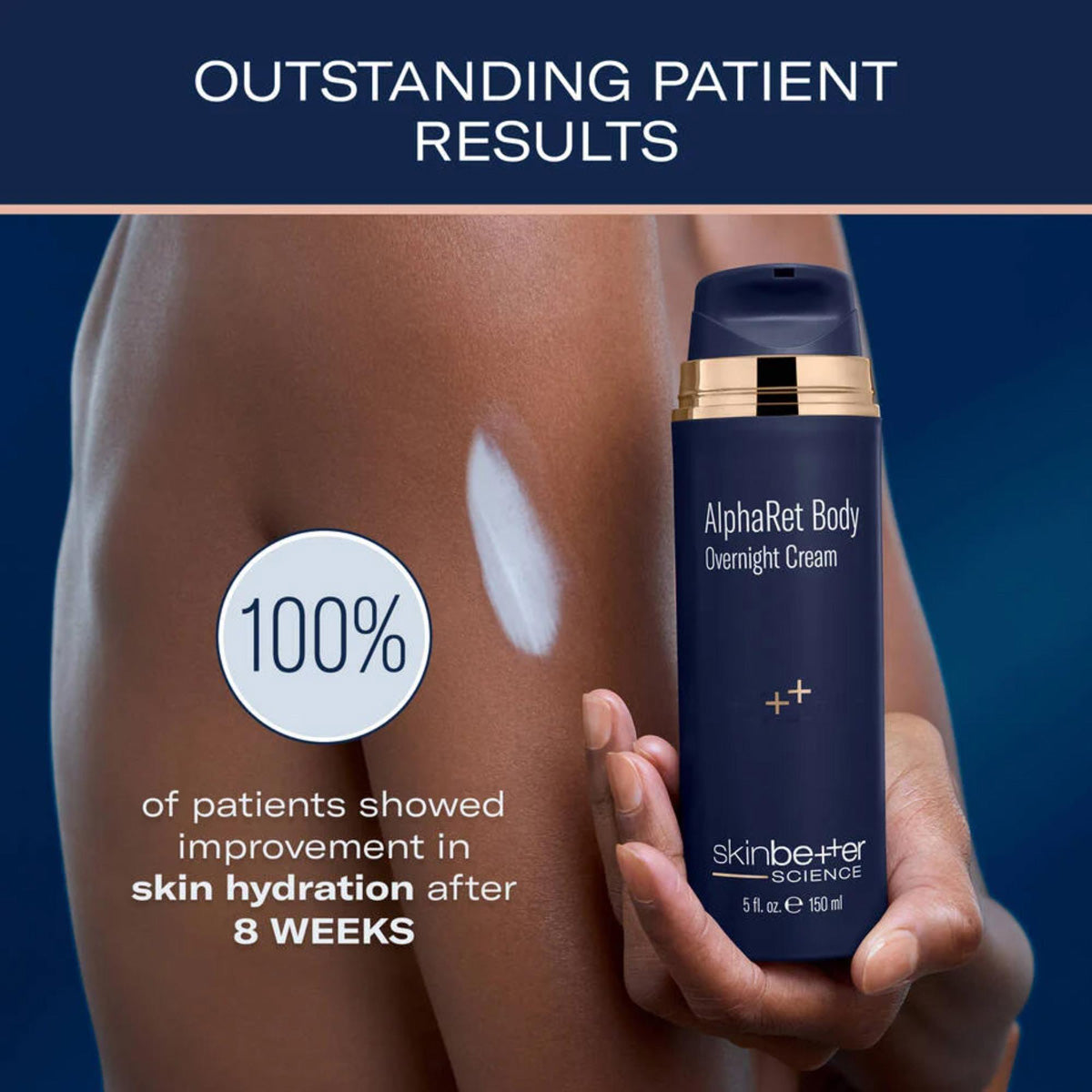 Skinbetter Science AlphaRet Body Overnight Cream patient results