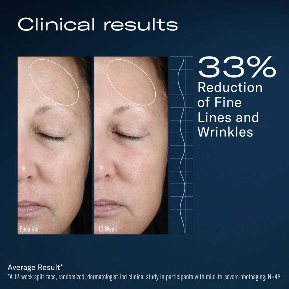 Skinbetter Science AlphaRet Overnight Cream before and after results
