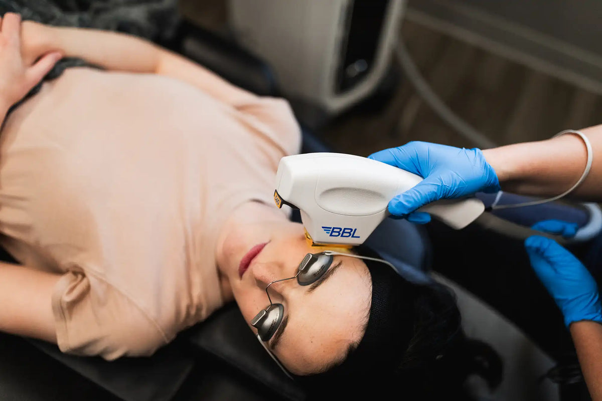 Clinician performing a BBL laser treatment on a reclining patient at Element Dermatology
