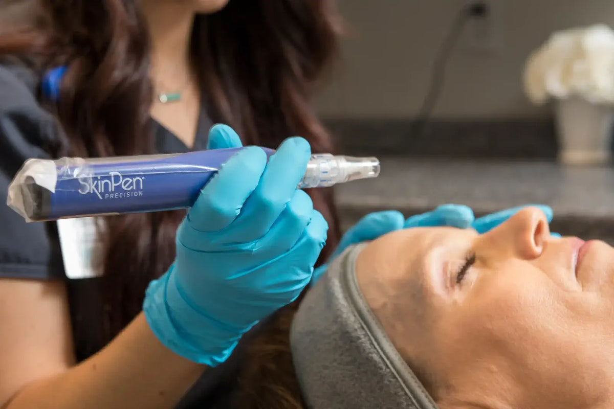 Clinician holding a SkinPen microneedling device above a patient's face at Element Dermatology